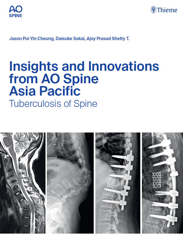 AO Spine books