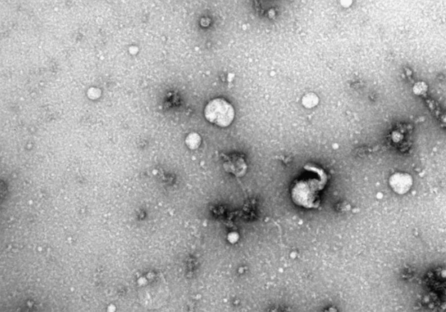 Der Verfahrenswechsel nach temporärer Fixierung im Polytrauma