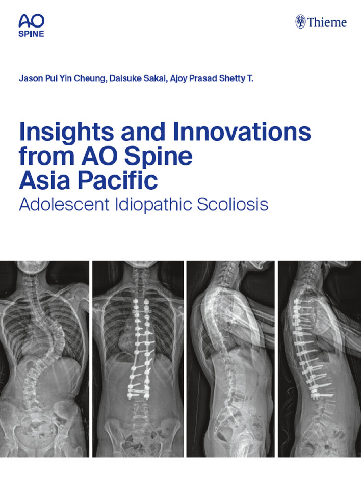 AO Spine books